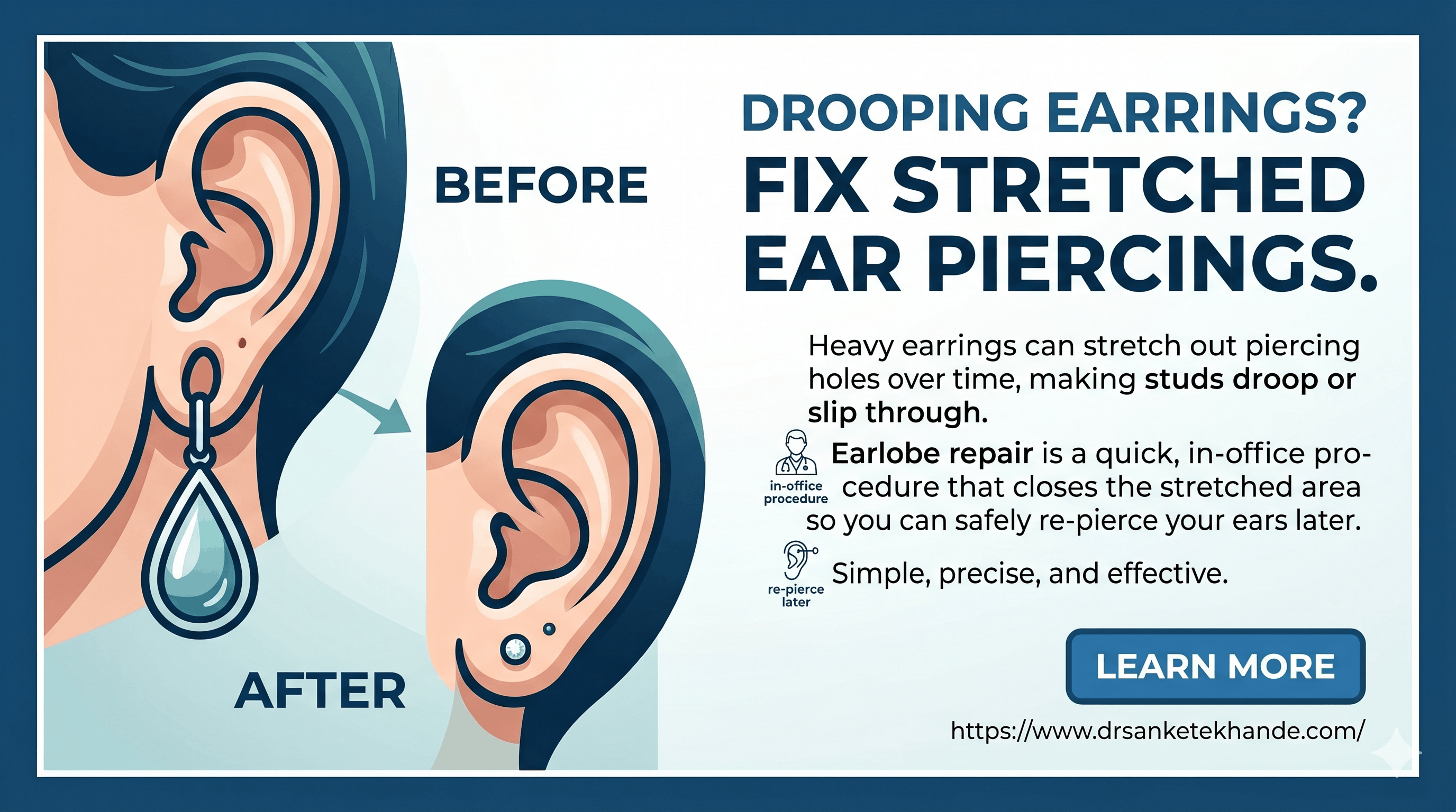 Earlobe Piercing to Heal